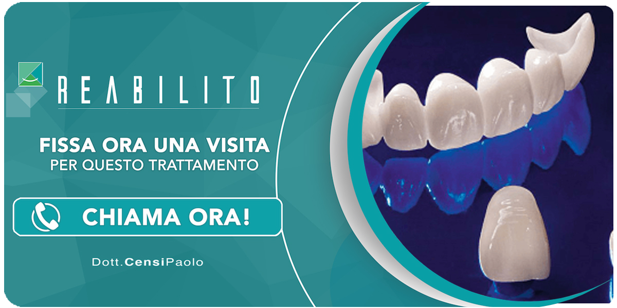 capsule-metal-free Anzola dell'Emilia (Bologna)