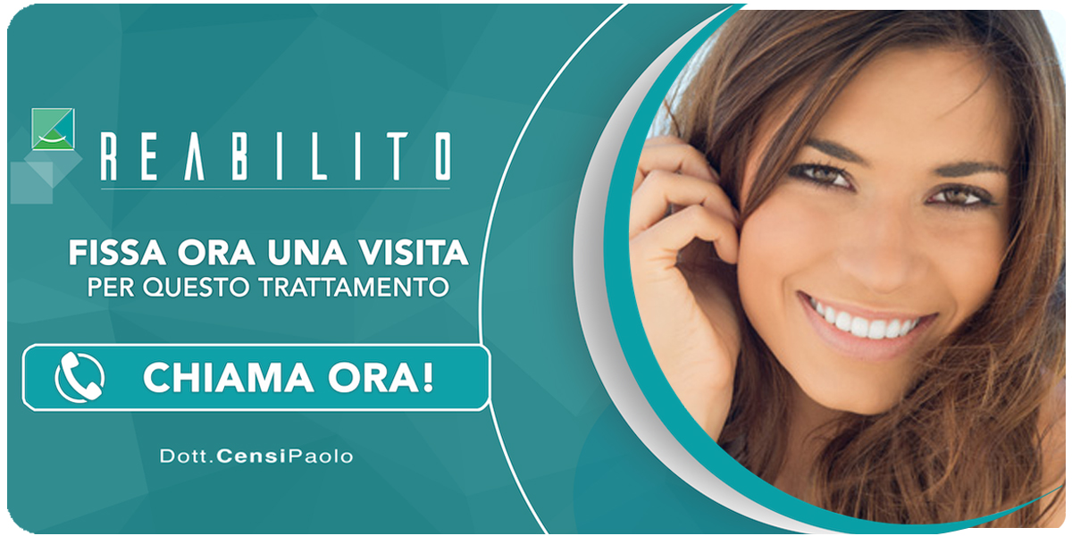 faccette-estetiche-dentali Anzola dell'Emilia (Bologna)