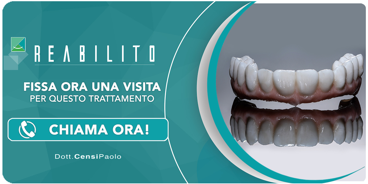 implantologia-a-carico-immediato Anzola dell'Emilia (Bologna)