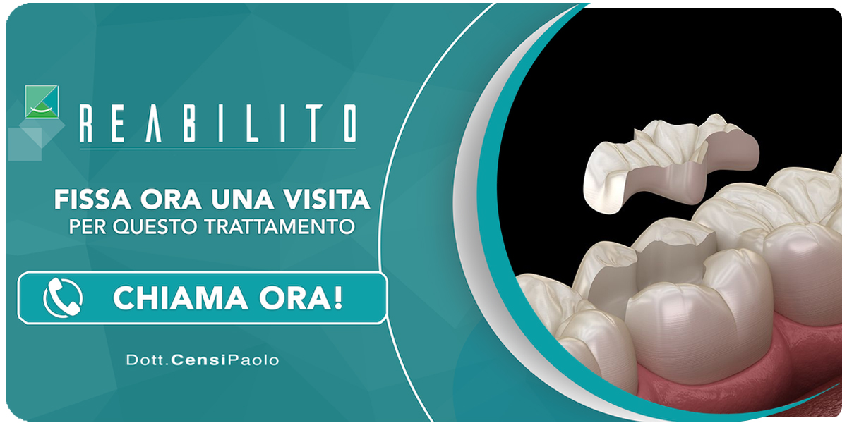 intarsio-dentale Anzola dell'Emilia (Bologna)