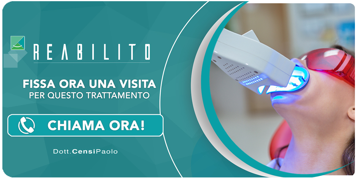 sbiancamento-dentale-professionale Anzola dell'Emilia (Bologna)